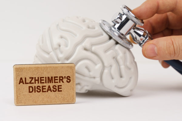 Ezek az Alzheimer-kór első jelei, amelyek már fiatalon jelentkezhetnek